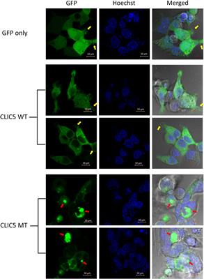 Cell-based analysis of CLIC5A and SLC12A2 variants associated with hearing impairment in two African families